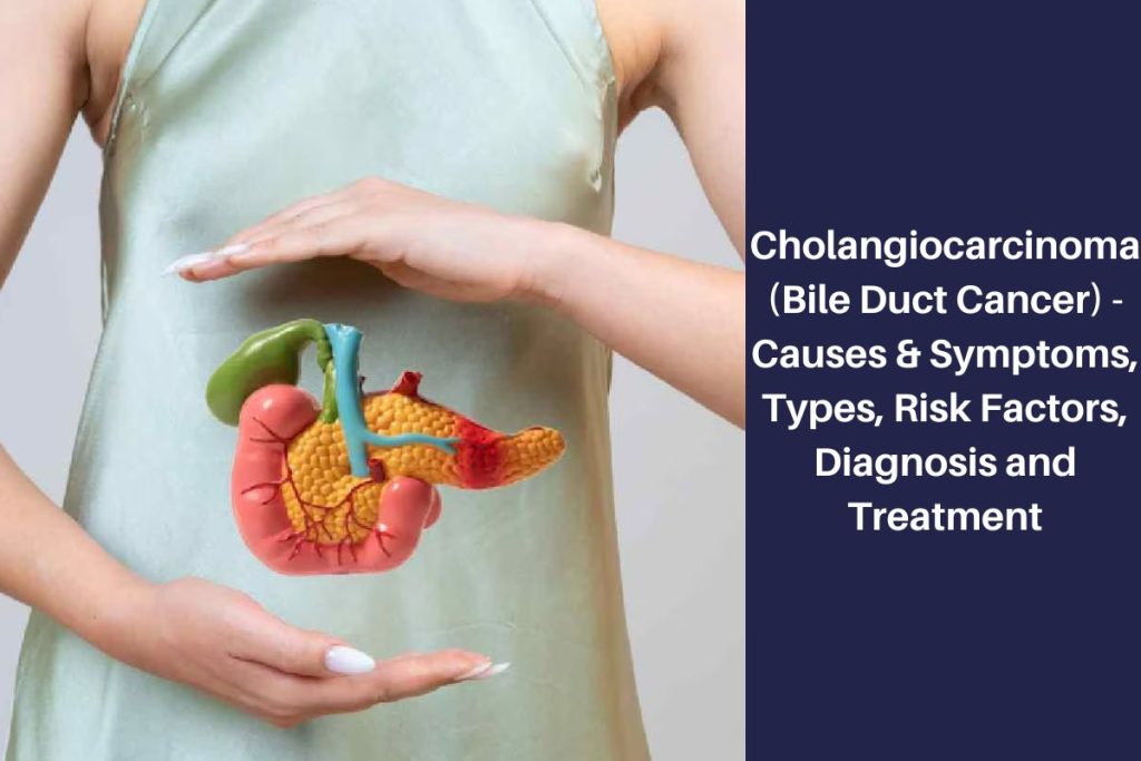 Cholangiocarcinoma (Bile Duct Cancer) - Causes & Symptoms, Types, Risk Factors, Diagnosis and Treatment