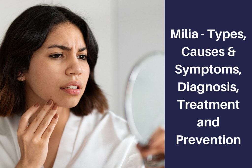 Milia - Types, Causes & Symptoms, Diagnosis, Treatment and Prevention