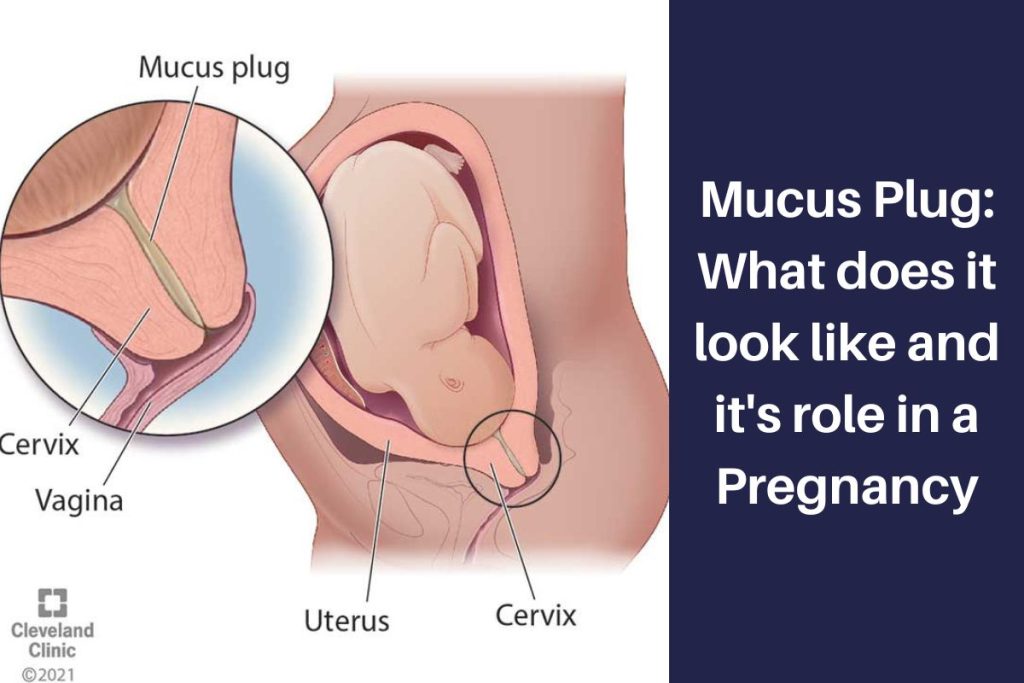 Mucus Plug: What does it look like and it's role in a Pregnancy