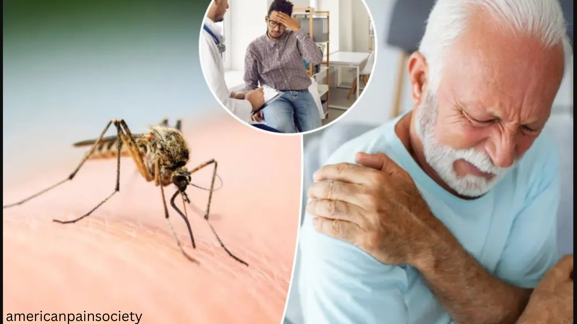 Chikungunya Symptoms