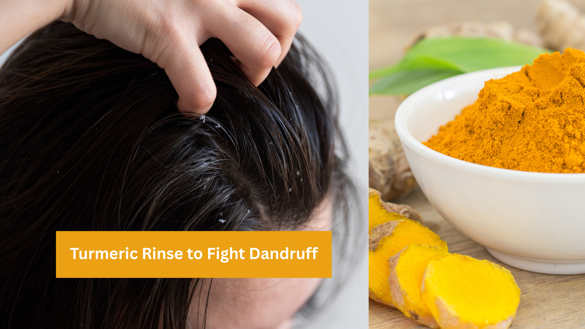 Turmeric Rinse to Fight Dandruff